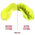 fluro-yellow-before-after-thumb_2000x.jpg
